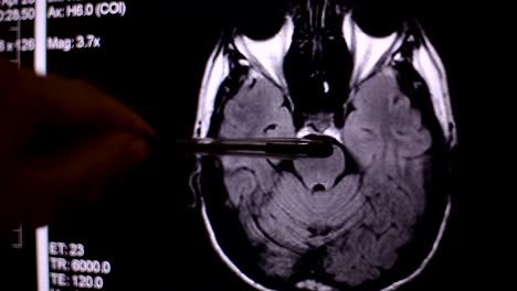 Blick-auf-Computer-Bildschirm-beim-Patienten-bewegt-sich-in-MRT-Gerät-Arzt,-analysiert-der-Arzt-die-Ergebnisse-der-Kernspintomographie-auf-seinem-Laptop.-4k,-Hintergrund-unscharf