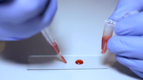 Lab-technician-holding-pipette-and-testing-blood-samples-on-hospital-ward-for-blood-transfusion,-hands-close-up.-Closeup-of-doctor-holding-test-tube-of-blood.-AIDS-/-HIV-Hospital-blood-test.