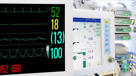 Equipos-medicos-en-UCI.-Cardiaca-y-Vital-muestra-control.