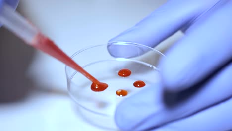 Técnico-de-laboratorio-manteniendo-la-pipeta-y-muestras-de-sangre-en-sala-del-hospital-para-transfusión-de-sangre,-las-manos-cerca-para-arriba.-Closeup-de-médico-sosteniendo-el-tubo-de-ensayo-de-la-sangre.-SIDA-/-VIH-Hospital-prueba-de-sangre.