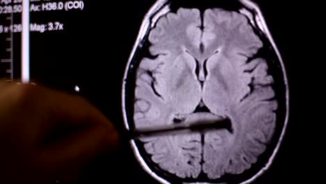 Blick-auf-Computer-Bildschirm-beim-Patienten-bewegt-sich-in-MRT-Gerät-Arzt,-analysiert-der-Arzt-die-Ergebnisse-der-Kernspintomographie-auf-seinem-Laptop.-4k,-Hintergrund-unscharf