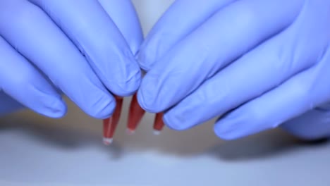 Lab-technician-holding-pipette-and-testing-blood-samples-on-hospital-ward-for-blood-transfusion,-hands-close-up.-Closeup-of-doctor-holding-test-tube-of-blood.-AIDS-/-HIV-Hospital-blood-test.