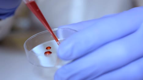 Técnico-de-laboratorio-manteniendo-la-pipeta-y-muestras-de-sangre-en-sala-del-hospital-para-transfusión-de-sangre,-las-manos-cerca-para-arriba.-Closeup-de-médico-sosteniendo-el-tubo-de-ensayo-de-la-sangre.-SIDA-/-VIH-Hospital-prueba-de-sangre.