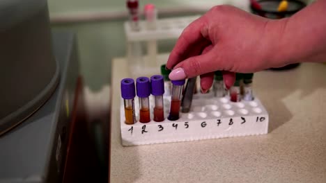 A-female-lab-assistant-is-preparing-blood-tests.-Modern-medical-technology.-Mtdicinal-lab.