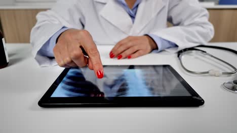 Weibliche-Ärztin-überprüft-Brust-Lunge-Xrays-auf-Tablet-Dolly-Schuss