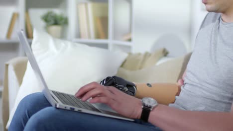 Man-with-Prosthetic-Arm-Working-on-Laptop