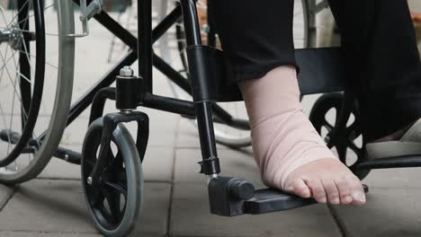 Patient-with-broken-leg-on-wheelchair-in-hospital