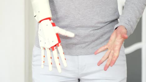 Patient-is-testing-his-new-robotic-prosthetic-hand-on-the-first-time