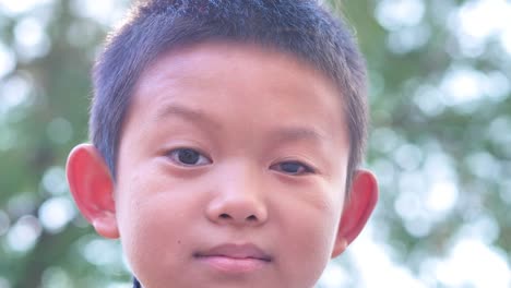 Close-up-face-of-asian-Boy.-The-left-eye-is-invisible-disabilities.--Slow-Motion