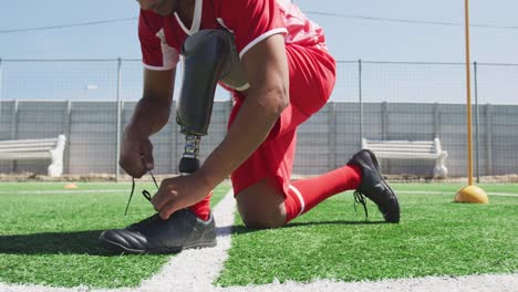 Soccer-player-with-prosthetic-leg-on-field