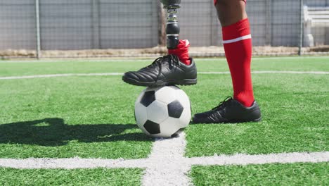 Futbolista-con-pierna-protésica-en-el-campo