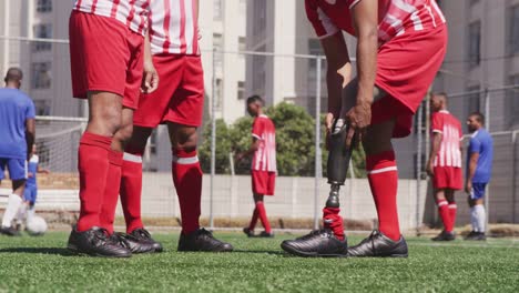 Soccer-player-remove-its-prosthetic-leg