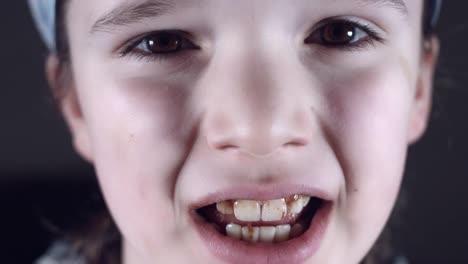 4k-Close-Up-Child-Mouth-Showing-Dirty-Teeth