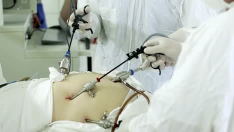 4K-The-team-of-medical-specialists-conducted-laparoscopic-surgery.