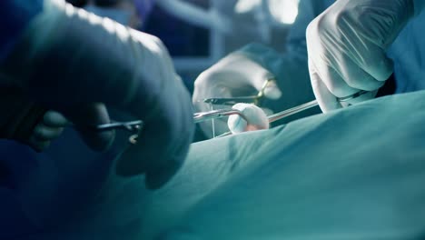 Primer-plano-en-las-manos-de-la-profesional-cirujano-sutura-la-herida-después-de-la-cirugía-exitosa.-En-la-sala-de-operación-de-fondo-moderno-Hospital.