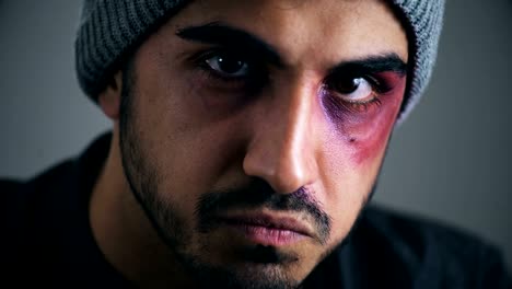 Young-latin-man-with-wounded-black-eye-staring-the-camera