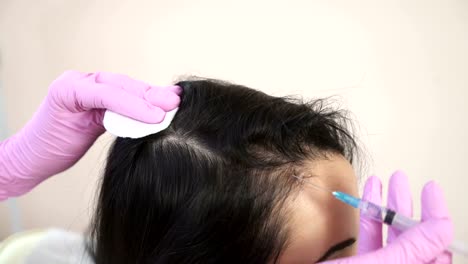 Needle-mesotherapy.-Cosmetic-been-injected-in-woman's-head.-Thrust-to-strengthen-hair-and-their-growth