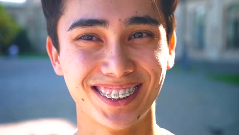 Beautiful-asian-happy-boy-is-laughing-in-braces-and-looking-aside,-while-standing-on-the-street