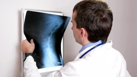 A-young-doctor-examines-the-results-of-a-patient's-X-ray-on-the-wall.-Analyzes-of-the-thorax-and-ribs