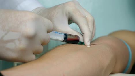 Krankenpfleger-dauert-eine-Blutprobe-für-Tests.-Hand-der-Arzt-injiziert-eine-Spritze-in-eine-Vene-des-Patienten.-Arm-des-Medic-Blutentnahme.-Nahaufnahme-Seitenansicht