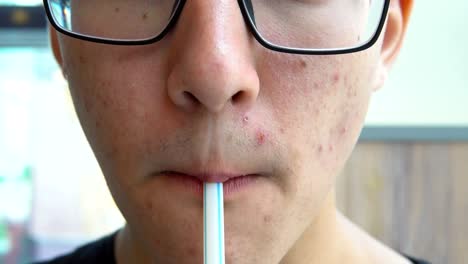 A-young-man-with-acne-on-his-face-drinks-soda-from-the-straw.