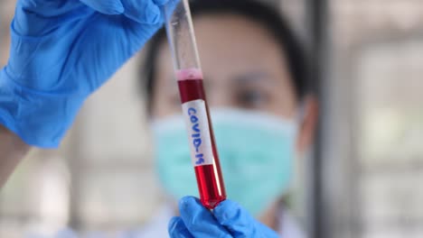 Doctor-holding-test-tube-blood-covid-19-in-the-lab