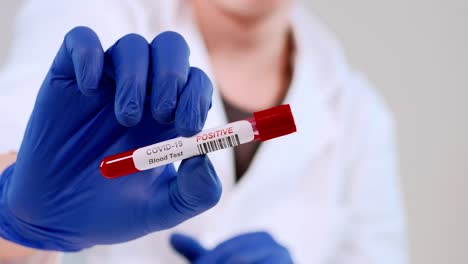 Coronavirus-infected-blood-sample-tube