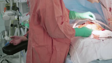 Surgeons-sew-up-stomach-of-woman.-Cesarean-section.-Hand-of-patient.-Hospital