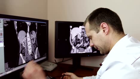 4K-müde-Arzt-nahm-seine-Brille-beim-Sitzen-auf-den-Monitoren-mit-einer-Röntgenuntersuchung.