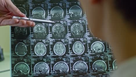 Doctor-Explaining-CT-Scan-of-Brain