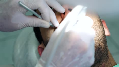 Dentista-de-perforar-un-diente-de-los-hombres