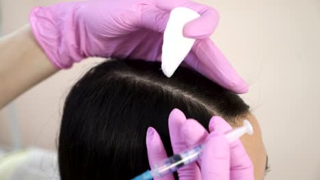 Needle-mesotherapy.-Cosmetic-been-injected-in-woman's-head.-Thrust-to-strengthen-hair-and-their-growth