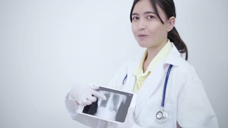 Mujer-doctora-muestra-y-explica-película-de-rayos-X-en-tableta