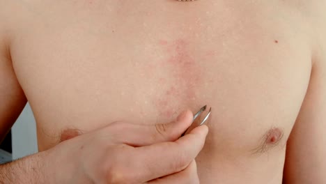 Close-up-of-a-man's-hand-will-pluck-out-his-chest-hair.