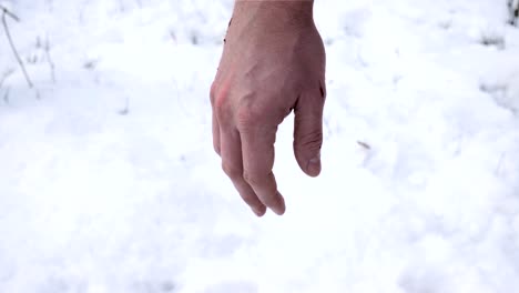 Blood-trickles-from-hand-to-the-snow.