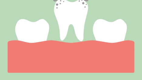 extracción-de-diente-por-herramientas-dentales,-diente-decaimiento-de-retiro