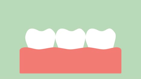 dental-crown,-installation-process-and-change-of-teeth