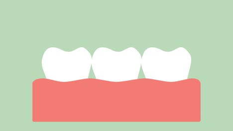 corona-dental,-proceso-de-instalación-y-cambio-de-los-dientes