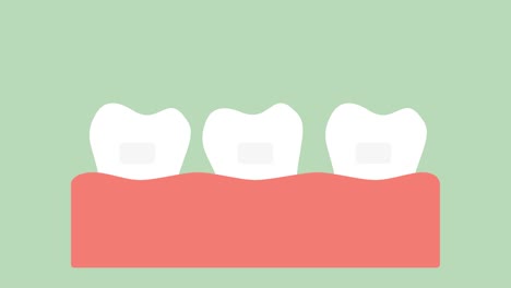 orthodontic-teeth-or-dental-braces