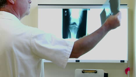 Ein-Arzt-Untersucht-Röntgenbilder
