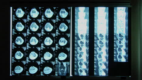 Lighting-illuminates-X-rays-on-a-wall