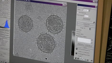 Der-Aids-Virus-Ist-Auf-Einem-Computerbildschirm-Modelliert