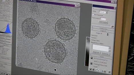 El-Virus-Del-Sida-Se-Ve-Modelado-En-Una-Pantalla-De-Computadora