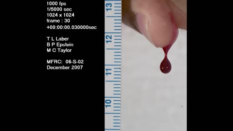 A-Forensics-Crime-Lab-Studies-A-Slow-Motion-Blood-Drop-From-A-Finger