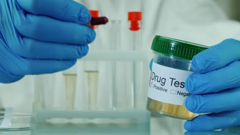 Analysis-of-urine-with-a-positive-result-for-doping