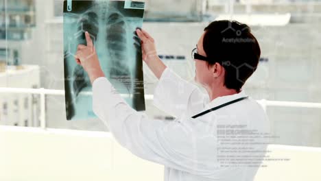 Animation-of-scientific-data-processing-over-caucasian-female-doctor-with-x-ray-photo