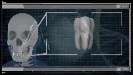 Animation-Von-Schädel,-Globus,-Zahn-Und-Diverser-Datenverarbeitung-Auf-Digitalem-Bildschirm
