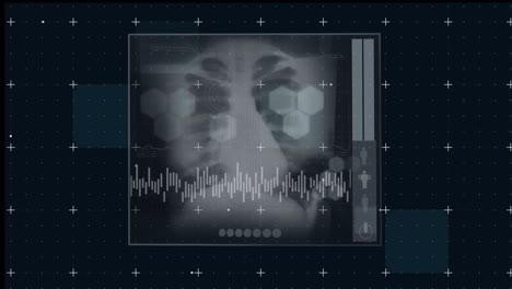 Animation-Eines-Schwarzen-Digitalen-Bildschirms-Mit-Röntgenfoto-Und-Grafiken