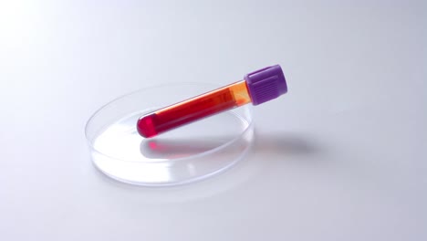 Close-up-of-blood-sample-and-petri-dish-on-white-background-with-copy-space,-slow-motion