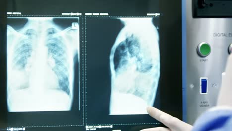 Arzt-Untersucht-Röntgenbild